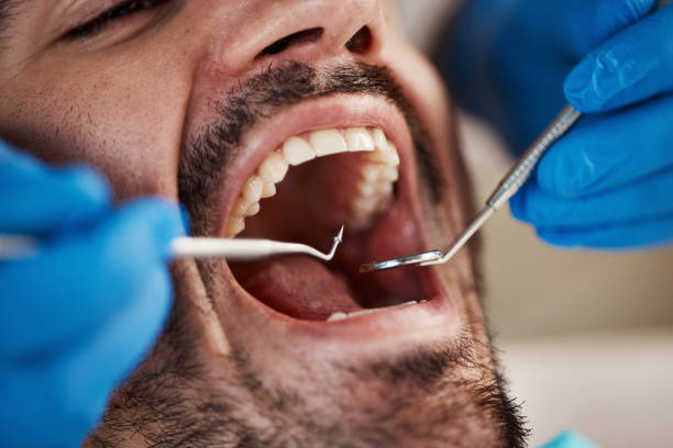 Best Pediatric Emergency Dentist in Fairbury, IL