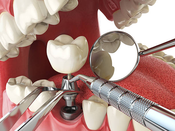Best Emergency Dental Surgery in Fairbury, IL